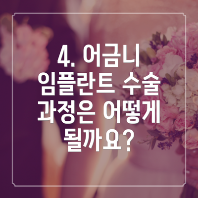 4. 어금니 임플란트 수술 과정은 어떻게 될까요?
